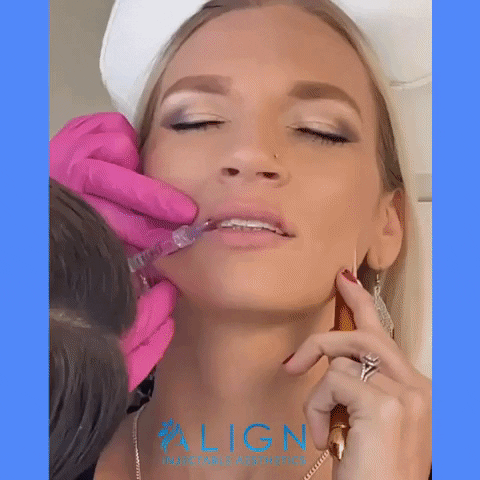 Botox Lip Filler GIF by Align Injectable Aesthetics