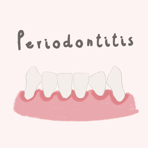 dentistdoodles perio periodoncia gingivitis periodontitis GIF