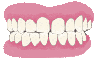 Braces Orthodontics Sticker