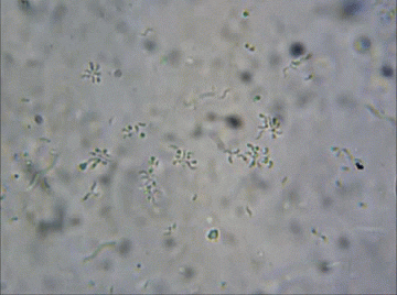 bacteria microbiology GIF