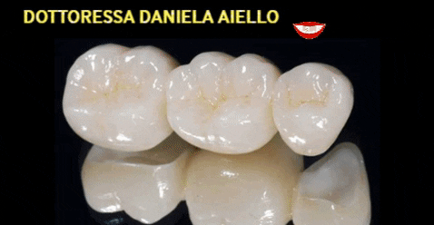 aiello giphygifmaker giphyattribution 1 teeth GIF