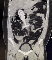 Mri GIF