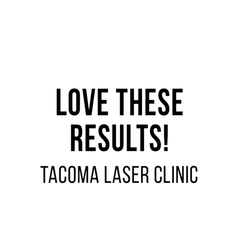 Sticker by Tacoma Laser Clinic