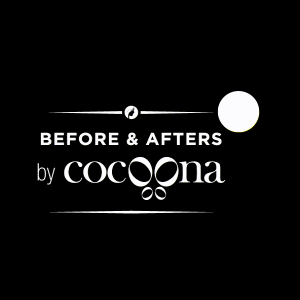 cocoonaclinic plasticsurgery beforeafter before after cocoona GIF