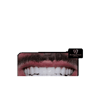 Happy Before And After Sticker by The Elegant Smile