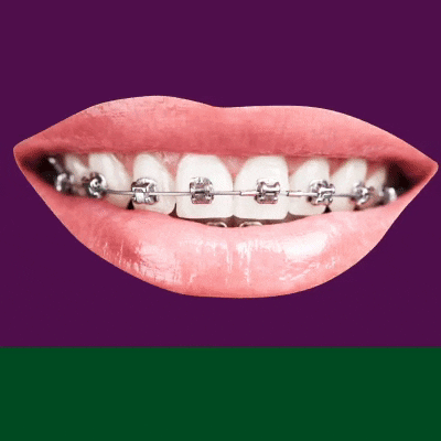 Teeth Dentist GIF by GOU Franquias - Find & Share on GIPHY