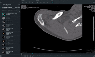 craig_purview medical imaging purview viva GIF