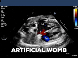 plabarta  GIF