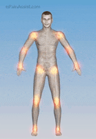 arthritis joint inflammation GIF by ePainAssist
