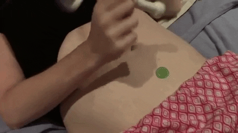 Baby Fetal Doppler -  At Home Portable Baby Heart Rate Monitor